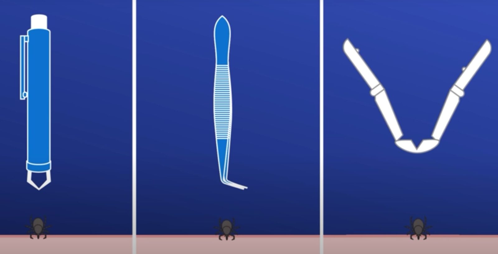 kullancs helyes eltávolítása videó