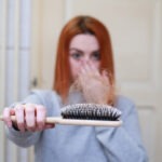 cukorbetegség hajhullás